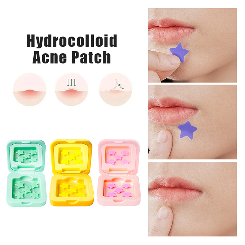 1Box Hydrocolloid Acne Patch F - Glass Break Detector recension och pris